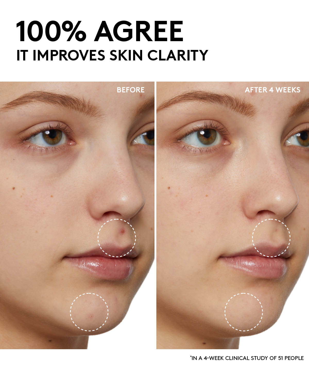 Fenty Skin Start’rs Full-Size Bundle: Oily Skin Edition