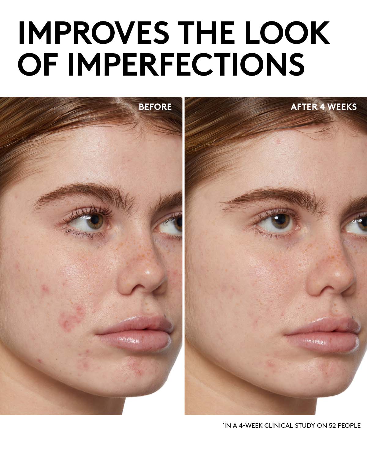 Fenty Skin Start’rs Full-Size Bundle with Mineral SPF: Oily Skin Edition